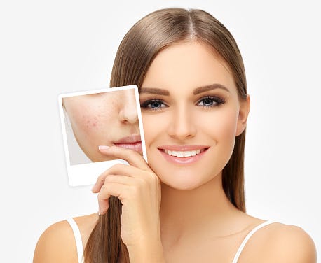 South Florida Face and Body Anti Wrinkle Injections